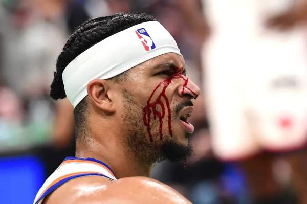 NBA直播app苹果版有哪些推荐？如何选择最适合的观看平台？